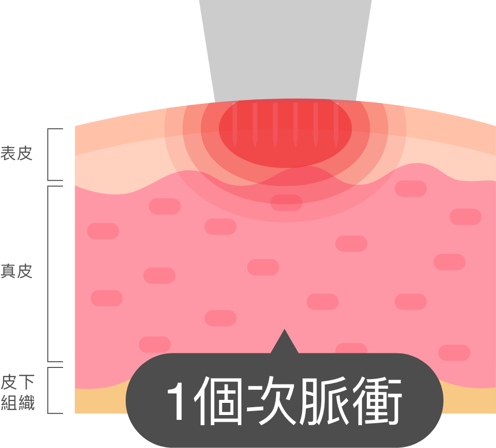 1個次脈衝