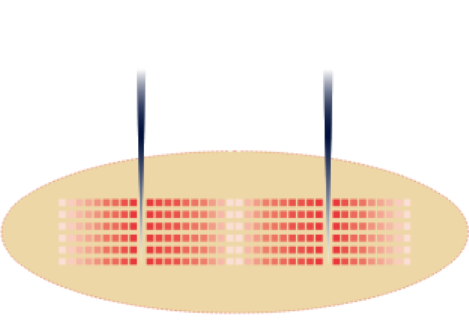 1 MHz